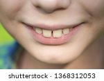 Closeup View Of Smiling Mouth...