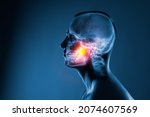 Small photo of X-ray of a man's head on blue background. Medical examination of head injuries. Jaw joint is highlighted by yellow red colour. Others x-ray images in my portfolio.