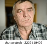 Small photo of Aged man with facial nerve paralysis, Bell's palsy.