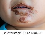 Small photo of A girl happily eats a chocolate cone and her mouth smacks of ice cream.