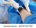Small photo of doctor performs skin graft in clinic or hospital, skin graft equipment