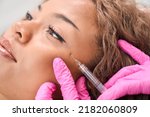 Small photo of Lady receives botulinum toxin injections in a cosmetology clinic